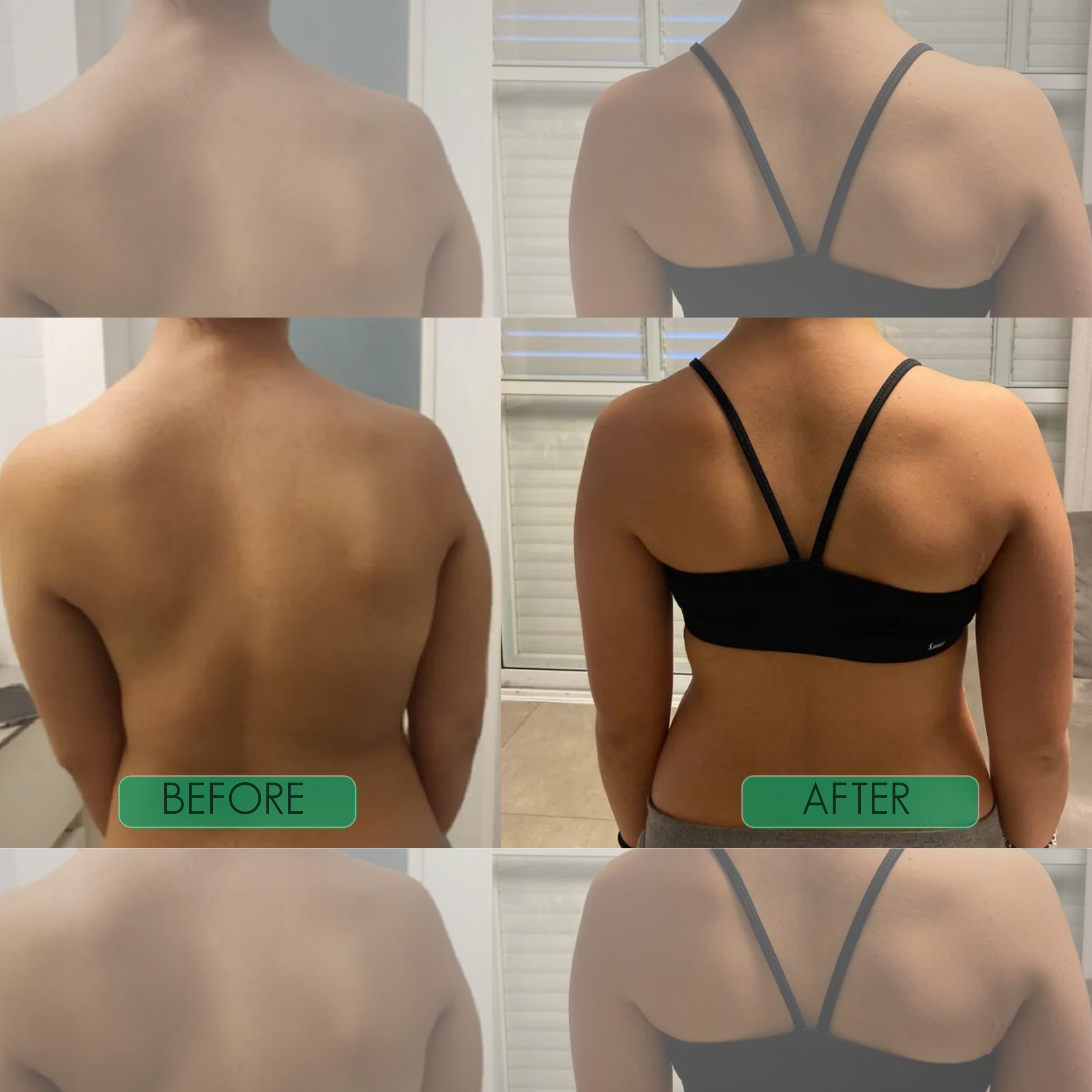 Instant Posture Correctorr
