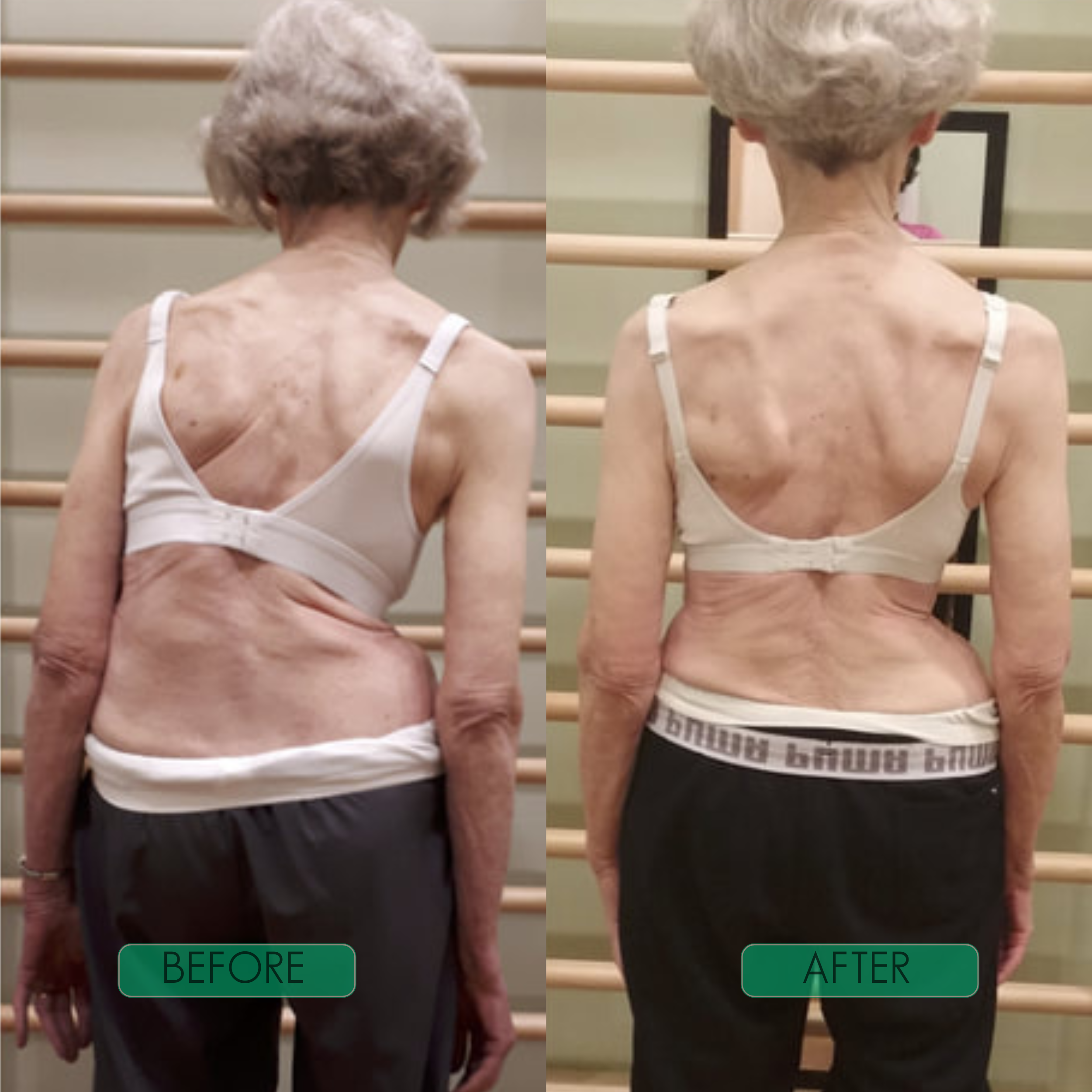 Spinal Re-Adaptation System