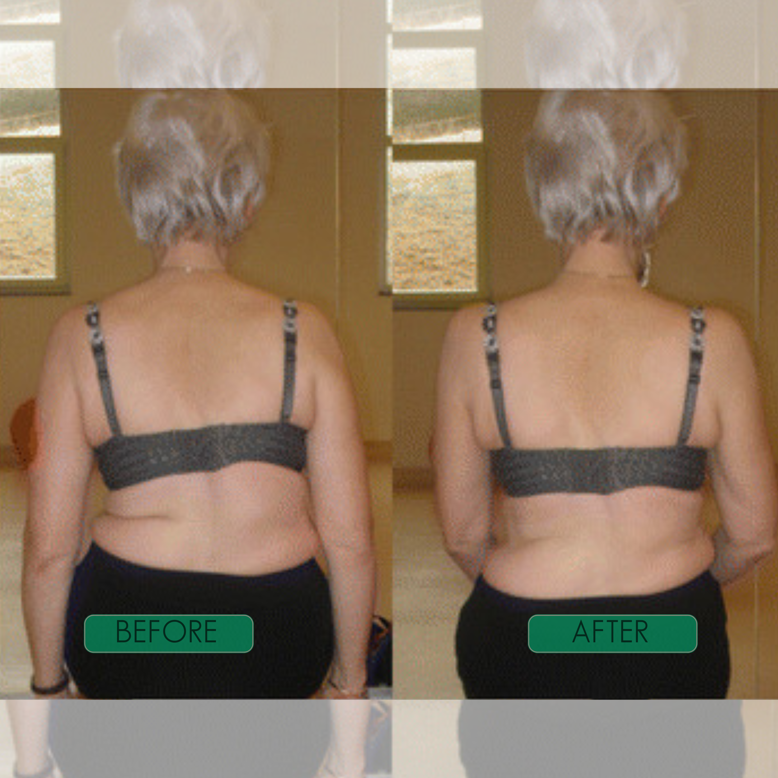 Spinal Re-Adaptation System