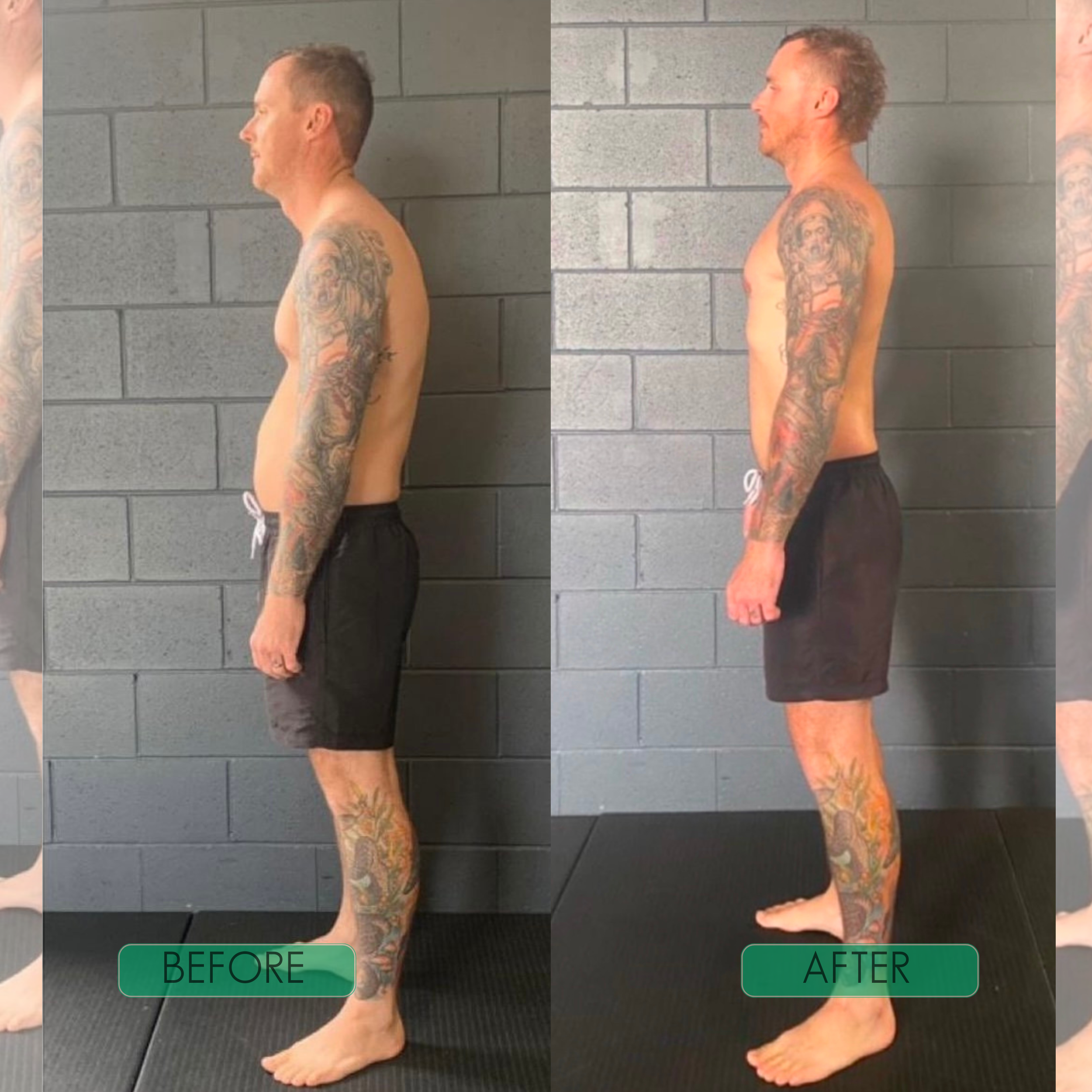 Instant Posture Corrector