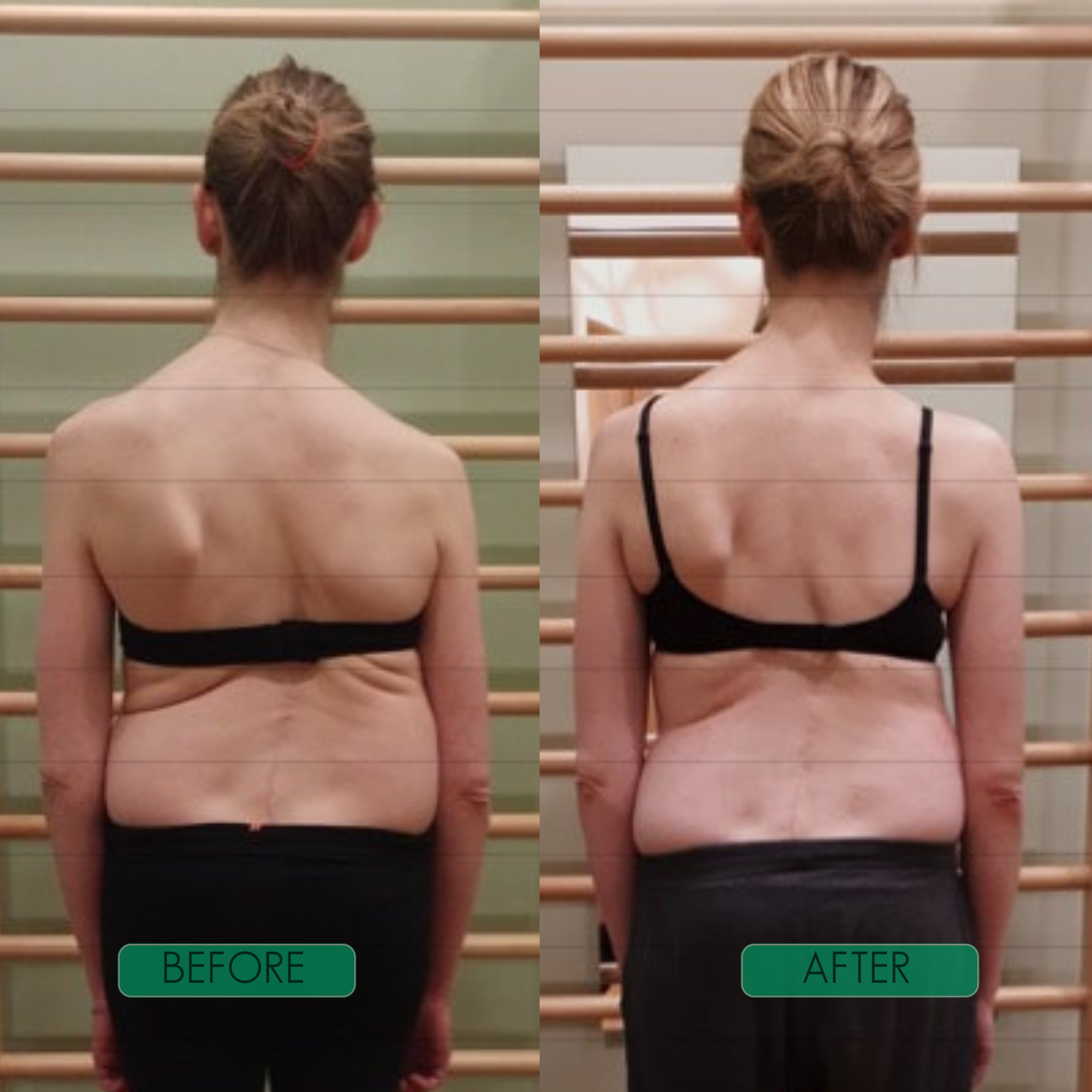 Spinal Re-Adaptation System